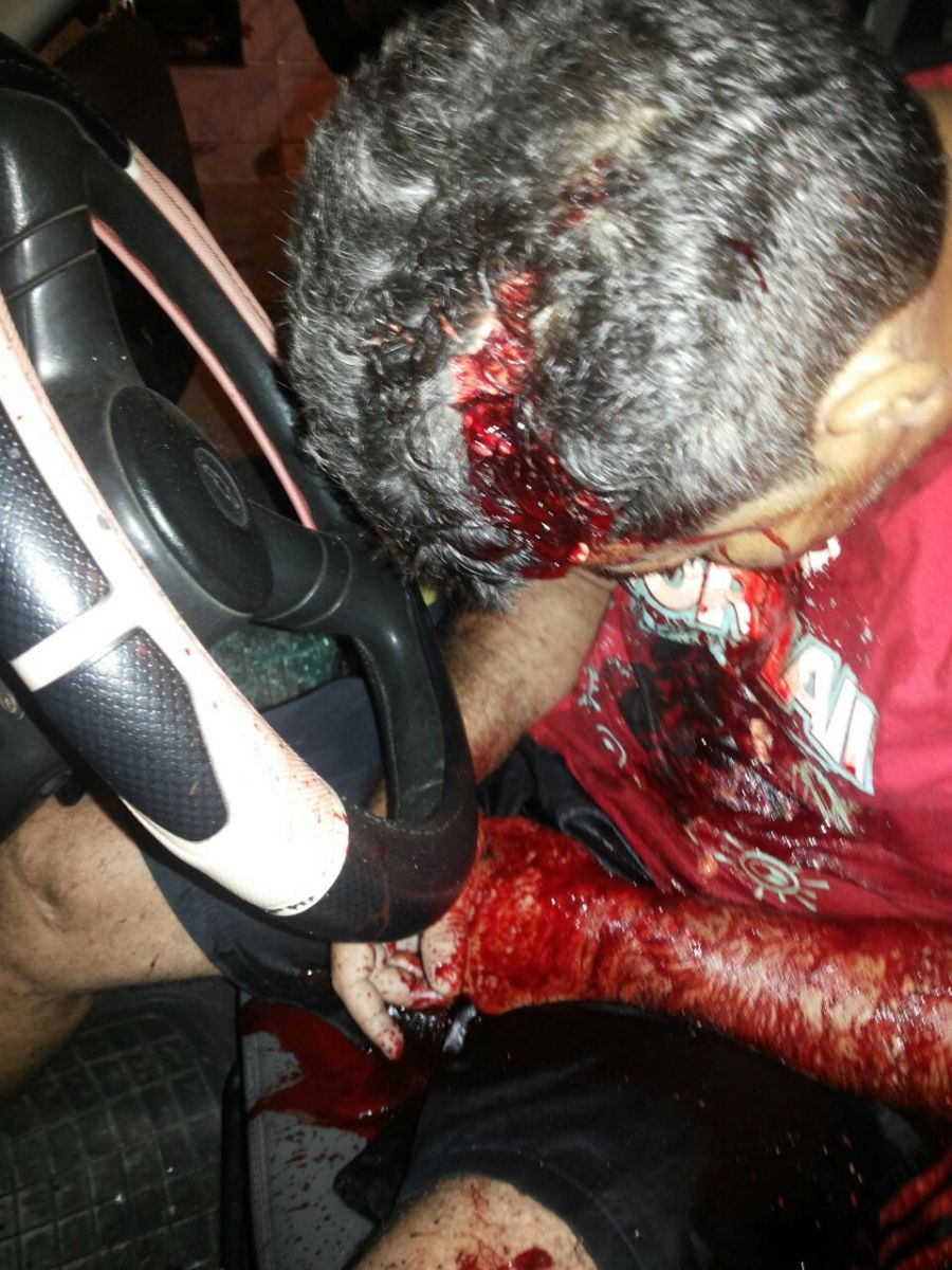 Noticías | Imagens fortes: Traficante é morto com cinco